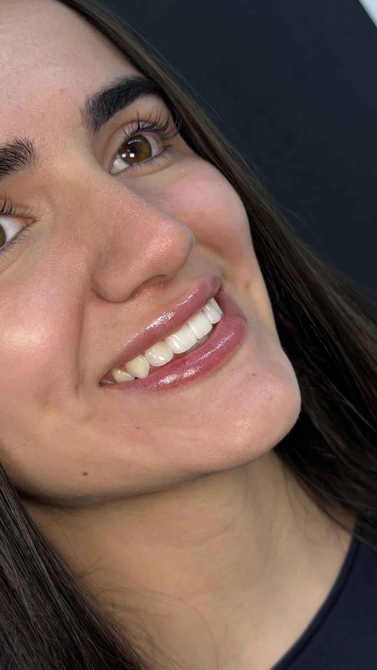 Mulher sorrindo com confiança, representando autoestima renovada