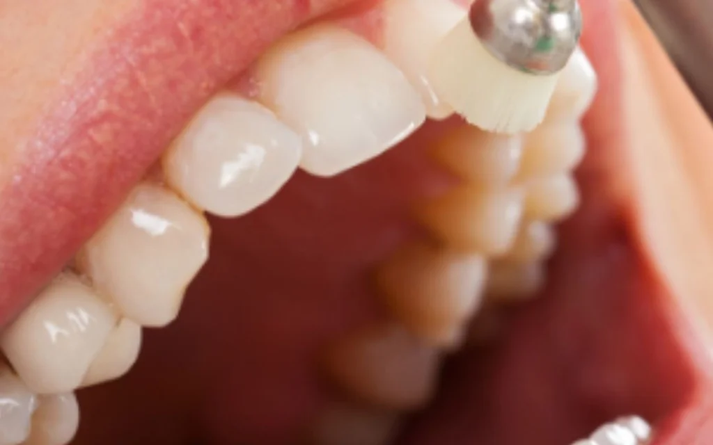 Limpeza odontológica profissional em ambiente clínico