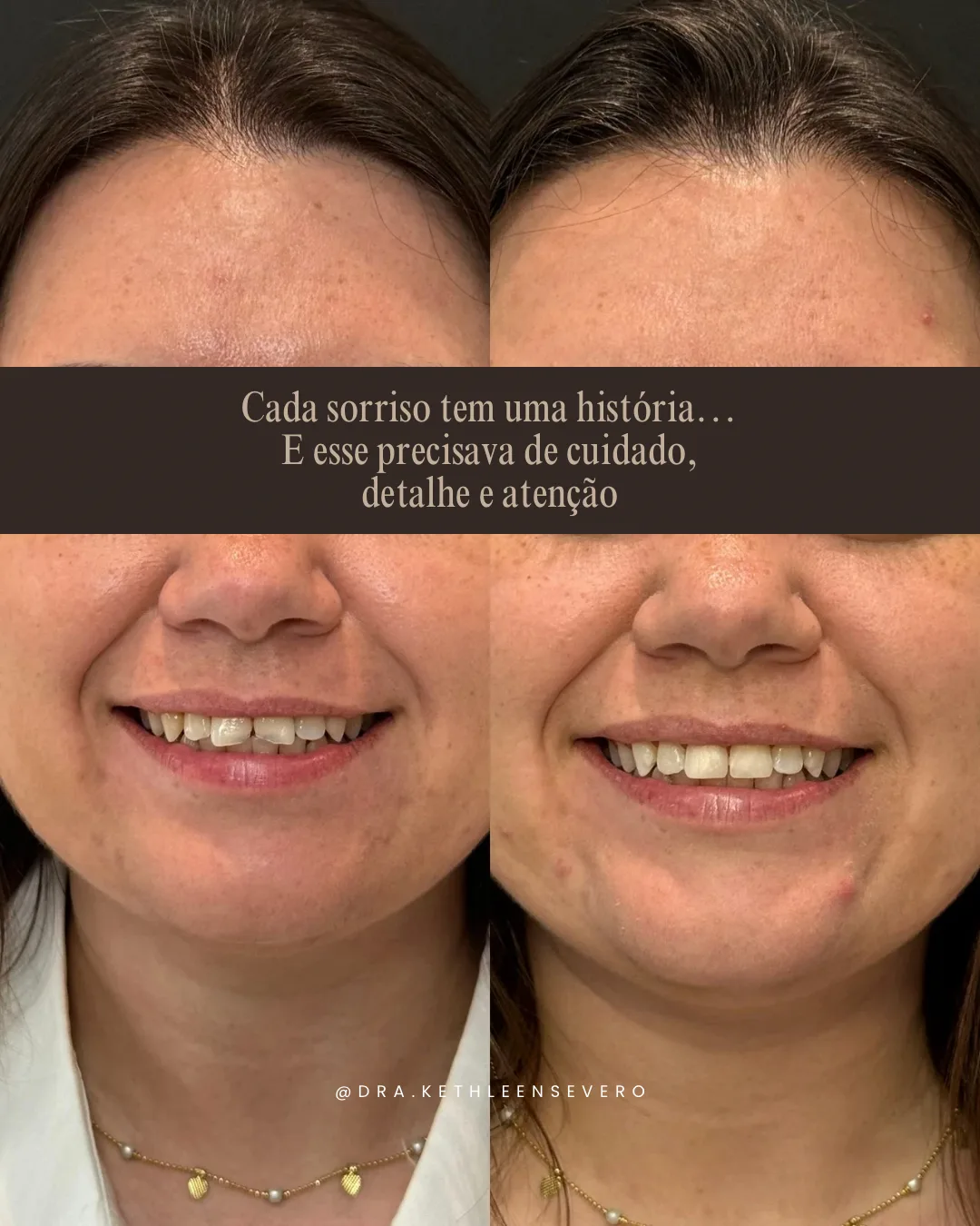 Sorriso — cuidado, detalhe e atenção