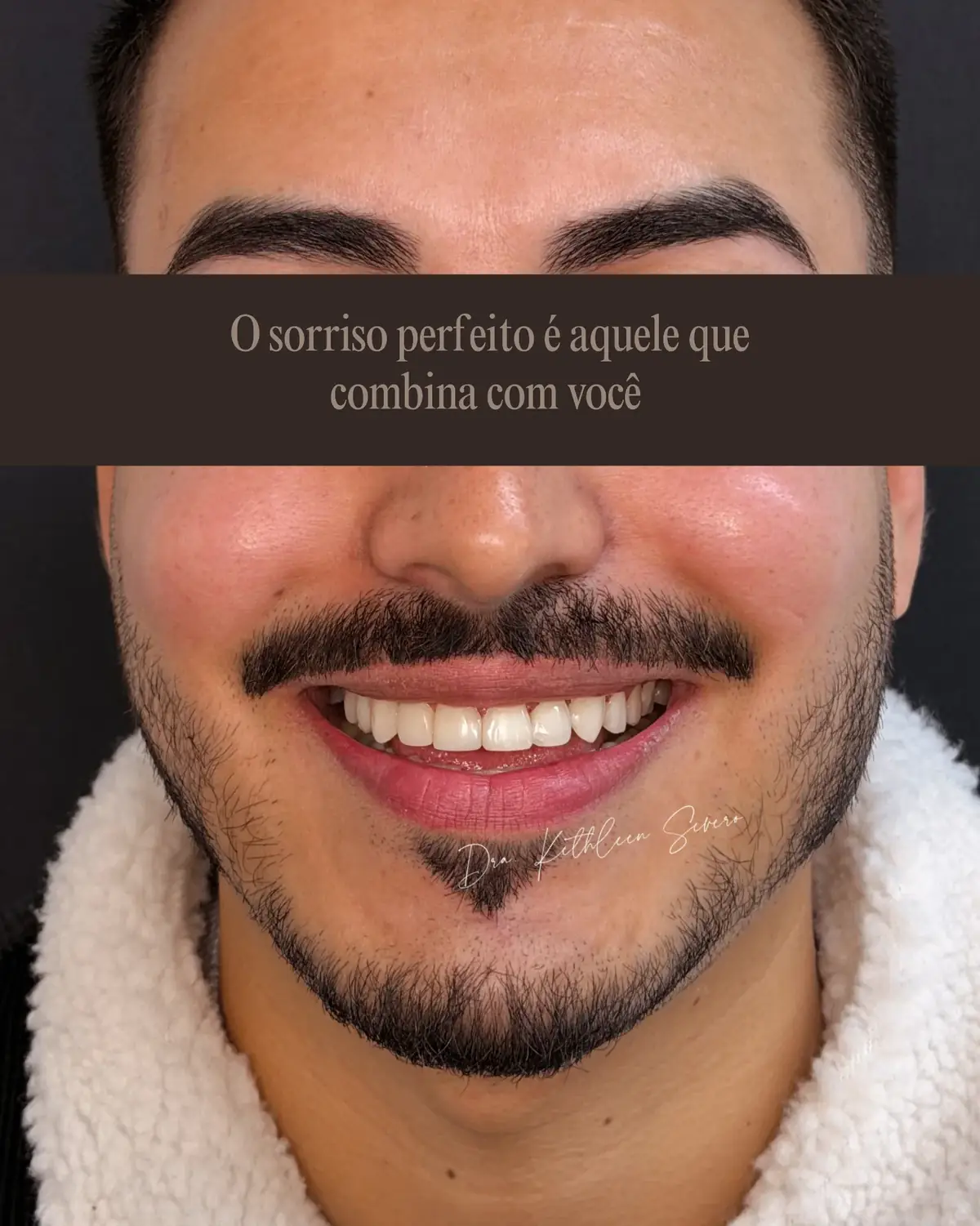 Sorriso — combinação natural